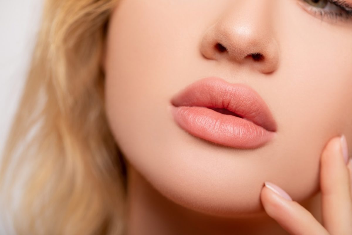 Lip Augmentation With Fillers
